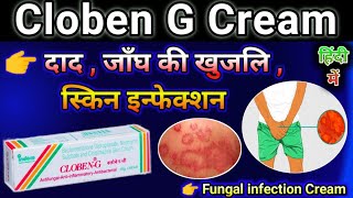 Cloben G Cream Uses in Hindi  Cloben cream use for Fungal infection  Skin disease Cream [upl. by Aneehsal]