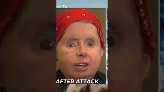 chimpanzee wiped out woman face viralvideo viralshorts animals monkey wildlife [upl. by Quillon]