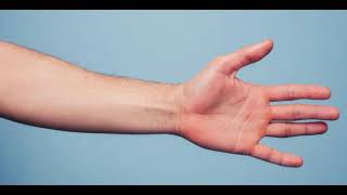 What is Palmar Erythema [upl. by Tehcac]