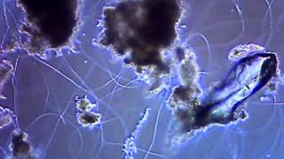 One drop of wastewater in a microscope [upl. by Zachariah324]