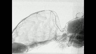 Folded Intersegmental Membrane FIM in a Honey Bee Abdomen [upl. by Henig]