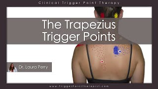 The Trapezius Trigger Points [upl. by Osnofla847]