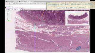 Histology Helper  Digestive System II Histology [upl. by Ynohtnaed]