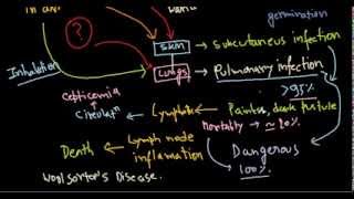 Bacillus anthracis infection [upl. by Noram95]