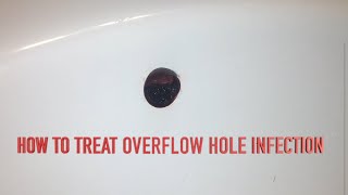 How to Treat Overflow Hole Infection [upl. by Gad]