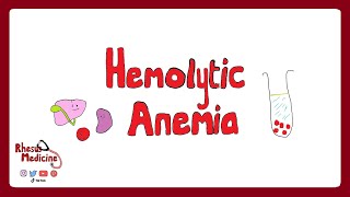 HEMOLYTIC ANEMIA Extravascular v Intravascular Clinical Features Diagnosis Coombs Test  Rhesus [upl. by Coppola]