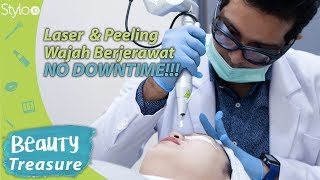 Laser Wajah amp Peeling untuk Menghilangkan Jerawat amp Flek Hitam No Downtime di Klinik SKINDA Jakarta [upl. by Bethena942]