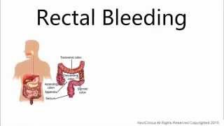 Rectal bleeding [upl. by Llenaej]