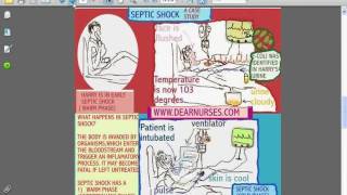 SESSIONS for NURSES 10  CARDIOGENIC AND SEPTIC SHOCK [upl. by Ednutabab552]