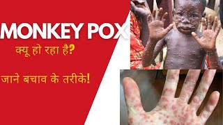 Kya covid jaisa hi hal kar dega monkey pox [upl. by Peedus971]