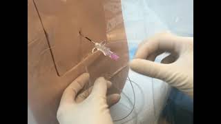 Neuraxial Task Trainer Demonstration  Epidural Anesthesia [upl. by Omrelliug601]