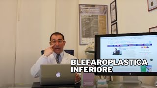 Blefaroplastica inferiore Dr Francesco Bernardini [upl. by Hna]