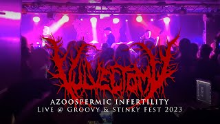 Vulvectomy quotAzoospermic Infertilityquot  Live  Groovy amp Stinky Fest 2023 [upl. by Clemens]