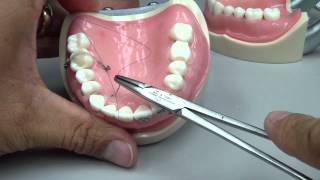 Root Coverage  Sling Suture [upl. by Littlejohn]