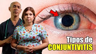 🛑Tipos de CONJUNTIVITIS 👀 Alérgicas Infecciosas y Químicas 👉🏻 ¿Cómo diferenciarlas ✔️ [upl. by Ykcin803]