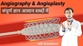 Angiography test kya hai kaise hoti hai Angiography vs CT Angiography in heart blockages  disease [upl. by Soirtemed278]