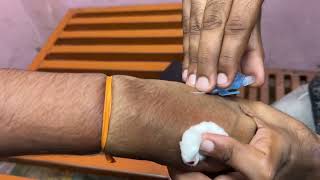 Intravenous cannula fixing subscribe doctor medicalequipment cannula [upl. by Vivien]