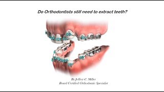 Do Orthodontists Still Need To Extract Teeth [upl. by Eiroc222]