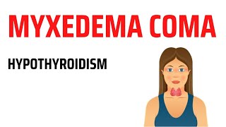 Myxedema Coma  Hypothyroidism [upl. by Ayomat]