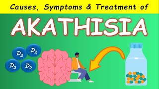 Akathisia by Antipsychotics  Causes Symptoms and Treatments [upl. by Job]