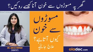 Masudo Se Blood Aane Ka Ilaj  Gums Bleeding Treatment In Urdu Danto Se Khoon Ane Ka Wajah Aur Ilaj [upl. by Connors]