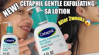 NEW CETAPHIL GENTLE EXFOLIATING SA LOTION FOR SKIN WITH COLOUR ALL SKIN TYPES [upl. by Chamkis]