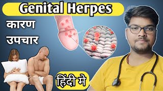 Genital herpes cause symptoms precautions and treatment in hindi simple to understand [upl. by Bellaude]