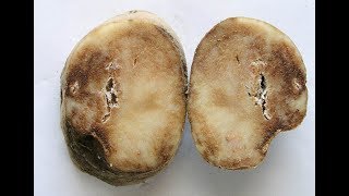 Introduction to Phytopthora late blight of potato [upl. by Puri]