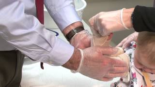 Osteogenesis Imperfecta  Long Arm and Long Leg Splint Demonstrations [upl. by Star]