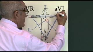 Heart disease 11 12 Lead EKG [upl. by Ambler]