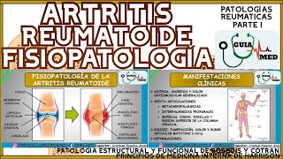 ARTRITIS REUMATOIDE FISIOPATOLOGÍA  GuiaMed [upl. by Rankin]