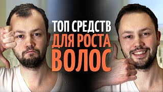 ТОП 5 средств для роста волос от врача дерматолога [upl. by Fazeli752]