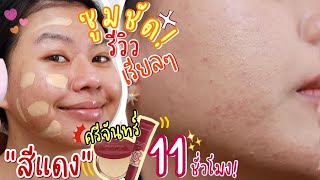 ผิวพังมาก ศรีจันทร์สร้างผิวหลอดแดงใหม่ เอาอยู่มั้ย ใช้จริงซูมชัด 11 ชั่วโมง  MAYNESSA [upl. by Onia]