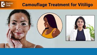 NEW VITILIGO TREATMENTCamouflage Treatment for Vitiligo Skin ColourDrAmee DaxiniDoctors Circle [upl. by Nawaj]