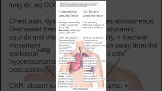 Spontaneous vs Tension Pneumothorax [upl. by Catharine450]