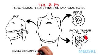 Abdominal Distension The 6 Fs that can help your diagnosis [upl. by Cartwright957]