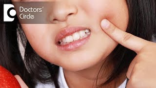 Tooth pain best Homeopathic treatment dental pain Homeopathic।Home remedy [upl. by Aloysia552]