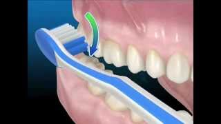 Tecniche di igiene orale Uso corretto dello spazzolino da denti [upl. by Kathe]