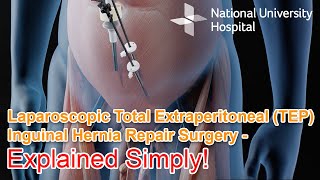 Laparoscopic Total Extraperitoneal TEP Inguinal Hernia Repair Surgery  Explained [upl. by Tuppeny]