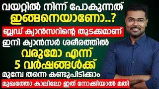 ബ്ലഡ് ക്യാൻസർ കോശങ്ങൾ ശരീരത്തിൽ ഉണ്ടെങ്കിൽ ആദ്യം കാണിക്കുന്ന ലക്ഷണങ്ങൾ  blood cancer symptoms [upl. by Nahtnoj]