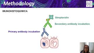 IV ISEP  Presentation Evaluation of protein NKX31 immunostaining in prostate carcinoma tissues [upl. by Nikos100]