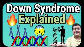 Down Syndrome explained  How it is caused [upl. by Arlinda]