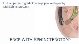 ERCP with sphincterotomy [upl. by Alexi]