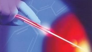 Krampfadern mit Laser behandeln [upl. by Itsym]