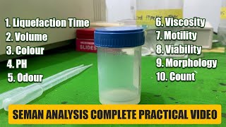 Semen Analysis Test Lab  Complete Practical Video  Medilablife [upl. by Shoshana]