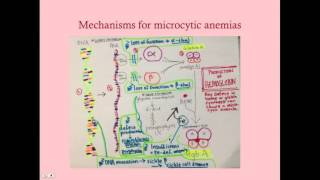 Microcytic Anemia  CRASH Medical Review Series [upl. by Letnohs]