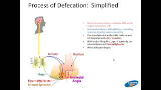 Anorectal Manometry HRAM [upl. by Elocim]