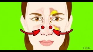 5 Façons efficaces de déboucher ton nez rapidement [upl. by Airdnalahs]