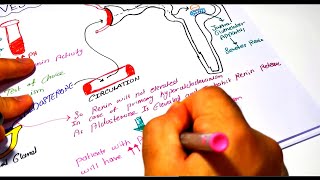 Hyperaldosteronism part II Investigation  approach to diagnosis  treatment [upl. by Carolynn]