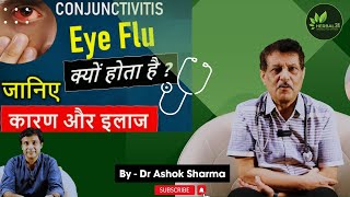 Eye Flu  conjunctivitis भयंकर गति से फैल रहा लोगों में रोग  लक्षणबचावनिदान  Eye flu herbal24 [upl. by Girardi]